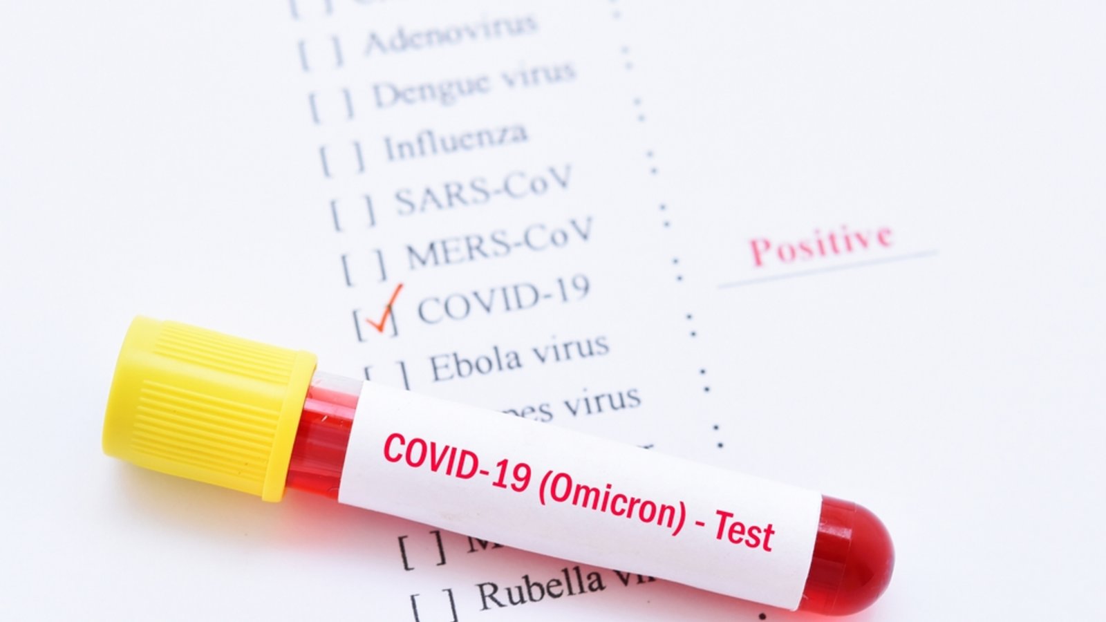 Was ist der CT-Wert und warum ist er wichtig für die Quarantäne?Foto: Jarun Ontakrai / shutterstock.com Was ist der CT-Wert und warum ist er wichtig für die Quarantäne?Foto: Jarun Ontakrai / shutterstock.com