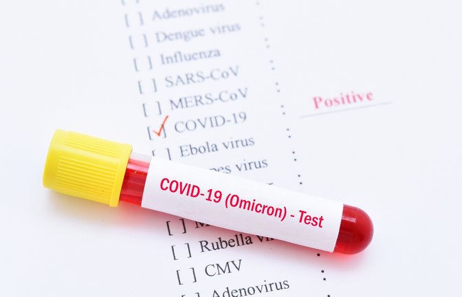 Was ist der CT-Wert und warum ist er wichtig für die Quarantäne?<span class='image-autor'>Foto: Jarun Ontakrai / shutterstock.com</span>
