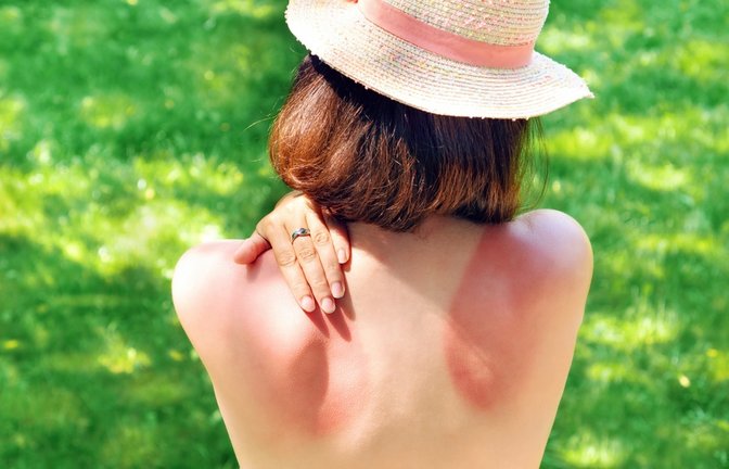 Diese Tipps helfen gegen das Jucken.<span class='image-autor'>Foto: nieriss / shutterstock.com</span>