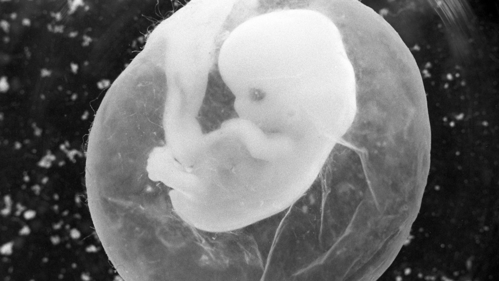 Ein sieben Wochen alter Fötus in der Fruchtblase. Bei einer Fehlgeburt ab der 13. Schwangerschaftswoche haben die betroffenen Frauen neuerdings Anspruch auf Mutterschutz.Foto: Peter Endig/dpa Ein sieben Wochen alter Fötus in der Fruchtblase. Bei einer Fehlgeburt ab der 13. Schwangerschaftswoche haben die betroffenen Frauen neuerdings Anspruch auf Mutterschutz.Foto: Peter Endig/dpa