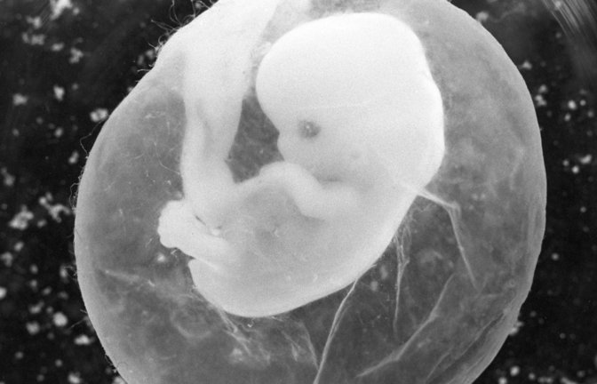 Ein sieben Wochen alter Fötus in der Fruchtblase. Bei einer Fehlgeburt ab der 13. Schwangerschaftswoche haben die betroffenen Frauen neuerdings Anspruch auf Mutterschutz.<span class='image-autor'>Foto: Peter Endig/dpa</span>