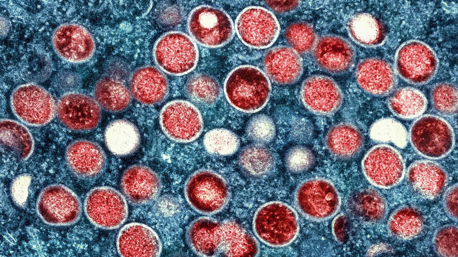 Partikel des Affenpockenvirus (rot) in einer infizierten Zelle (blau). Die Affenpocken-Fälle in Europa steigen an.Foto: Niaid/Niaid/Planet Pix via ZUMA Press Wire/dpa