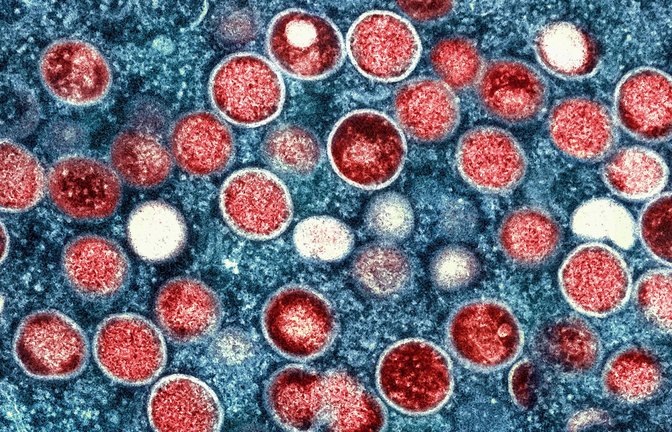 Partikel des Affenpockenvirus (rot) in einer infizierten Zelle (blau). Die Affenpocken-Fälle in Europa steigen an.<span class='image-autor'>Foto: Niaid/Niaid/Planet Pix via ZUMA Press Wire/dpa</span>