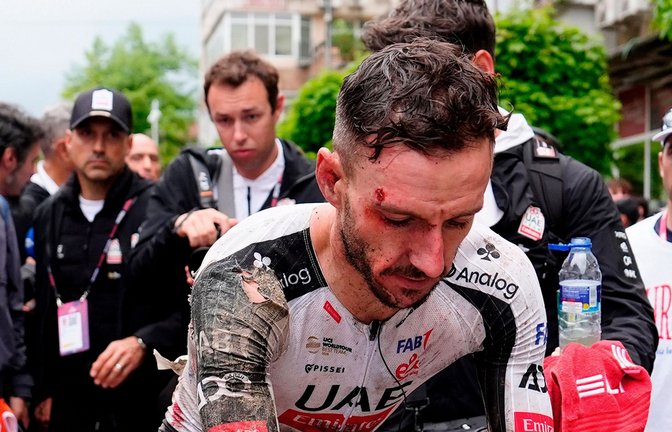 Trotz seines schweren Sturzes fuhr Adam Yates zunächst weiter.<span class='image-autor'>Foto: Fabio Ferrari/LaPresse/AP/dpa</span>