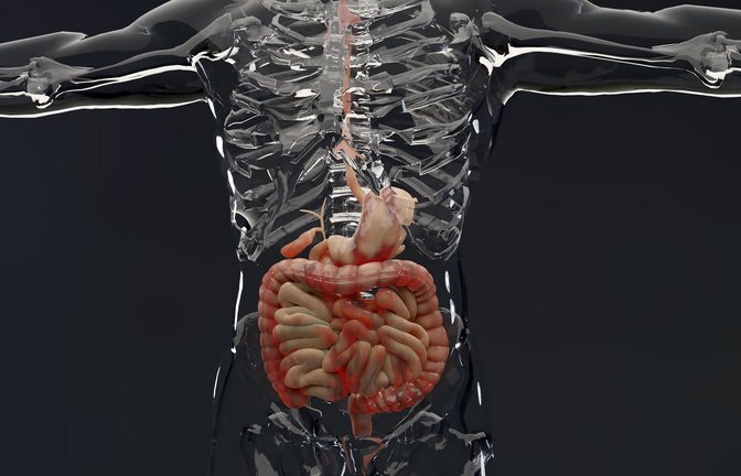 Beim Morbus Crohn ist meistens der letzte Teil des Dünndarms, des Dickdarms und der Darmwand betroffen, aber auch andere Teile des Verdauungstrakts.<span class='image-autor'>Foto: Imago/Depositphotos</span>