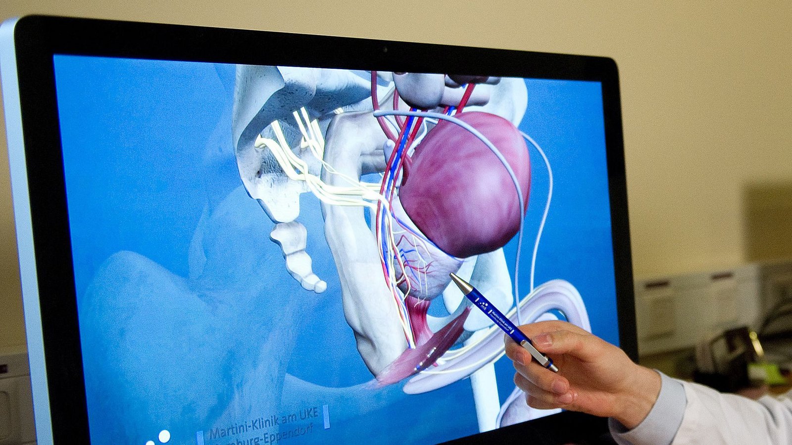 Statistisch gesehen, wird mit der Tastuntersuchung  von zehn Prostatatumoren nur einer entdeckt.Foto: picture alliance / dpa/Axel Heimken