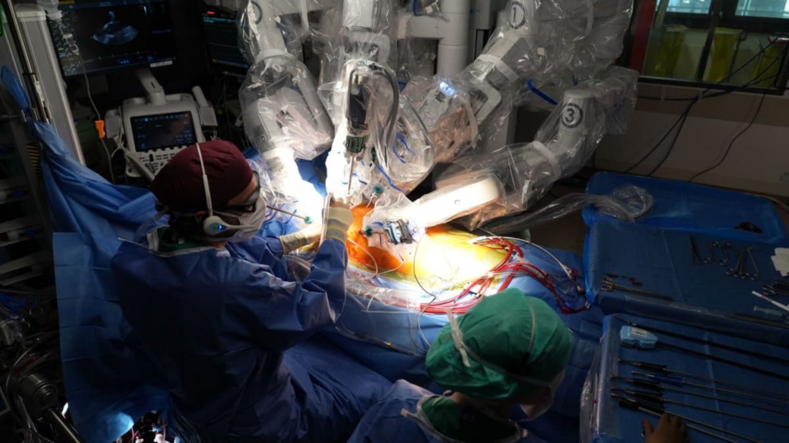 Eine Herz-OP mit Roboter an der Charité in Berlin: Künstliche Intelligenz (KI) findet im Gesundheitswesen einen Wachstumsmarkt. Auch für Baden-Württemberg ergeben sich aus dem Einsatz von KI Chancen.Manuel Genolet/dpa Eine Herz-OP mit Roboter an der Charité in Berlin: Künstliche Intelligenz (KI) findet im Gesundheitswesen einen Wachstumsmarkt. Auch für Baden-Württemberg ergeben sich aus dem Einsatz von KI Chancen.Manuel Genolet/dpa
