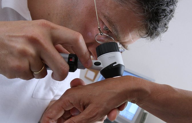 Beim Screening kann Hautkrebs frühzeitig erkannt werden.  <span class='image-autor'>Foto: dpa</span>