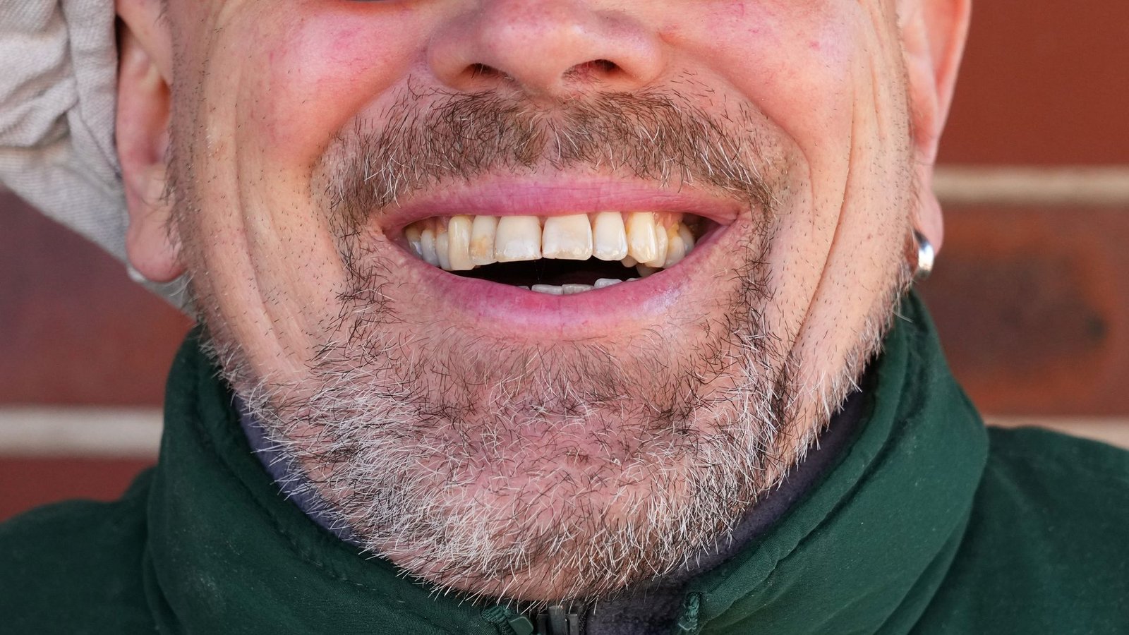 Könnte Lachen ein Therapieansatz werden?Foto: Soeren Stache/dpa-Zentralbild/dpa