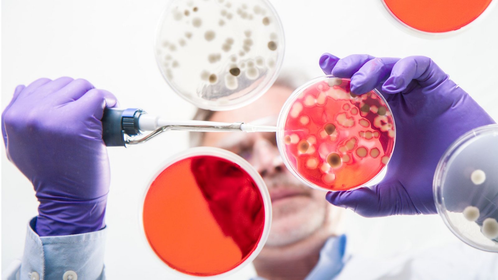 Damit auch in Zukunft effektive Medikamente gegen bakterielle Infektionserkrankungen verfügbar sind, werden Antibiotika benötigt, die andere Zielstrukturen der Bakterien adressieren als alle Wirkstoffe, die bereits klinisch verwendet werden (Symbolfoto).Foto: Imago/Panthermedia Damit auch in Zukunft effektive Medikamente gegen bakterielle Infektionserkrankungen verfügbar sind, werden Antibiotika benötigt, die andere Zielstrukturen der Bakterien adressieren als alle Wirkstoffe, die bereits klinisch verwendet werden (Symbolfoto).Foto: Imago/Panthermedia