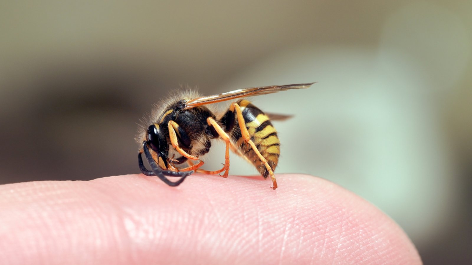 Klicken Sie sich durch unsere Bildergalerie mit Wespenstichen.Foto: Irina Kozorog / shutterstock.com Klicken Sie sich durch unsere Bildergalerie mit Wespenstichen.Foto: Irina Kozorog / shutterstock.com