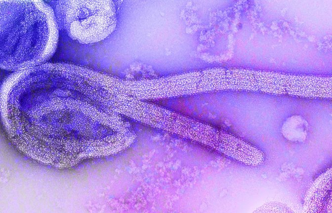 Eine elektronenmikroskopische Aufnahme des Marburgvirus.<span class='image-autor'>Foto: Dr. Frederick Murphy/CDC/dpa</span>