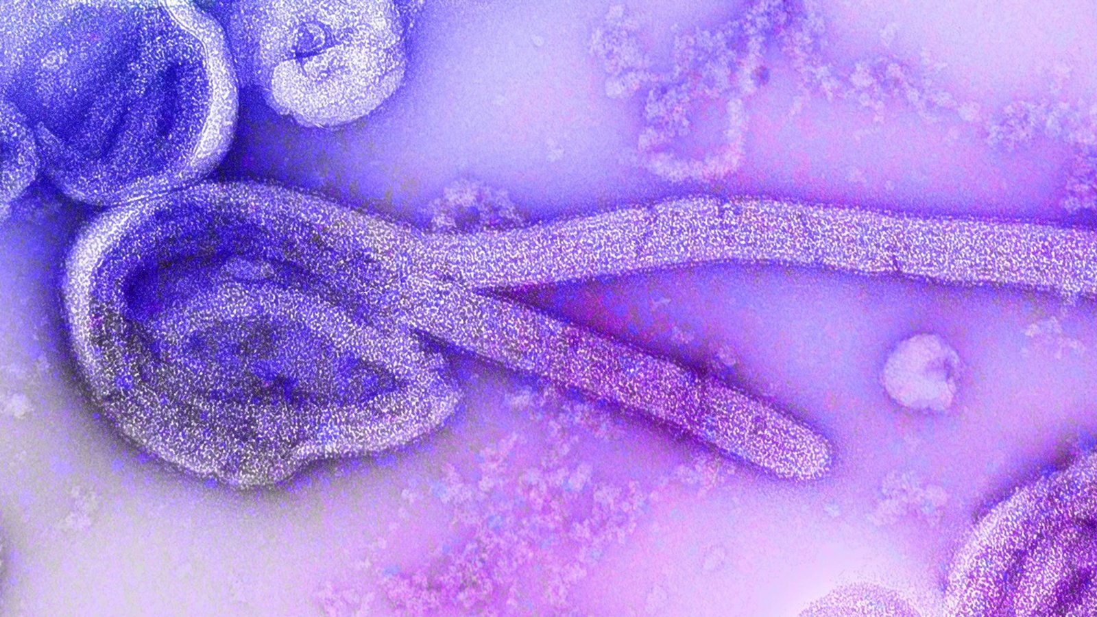 Eine elektronenmikroskopische Aufnahme des Marburgvirus.Foto: Dr. Frederick Murphy/CDC/dpa