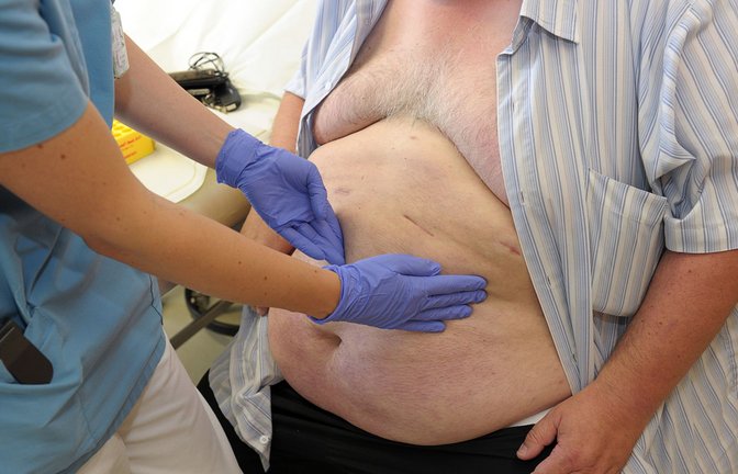 Als adipös gilt in Deutschland ein Mensch mit einem Body-Maß-Index (BMI) von 30 oder mehr. (Symbolbild)<span class='image-autor'>Foto: picture alliance / dpa/David Ebener</span>
