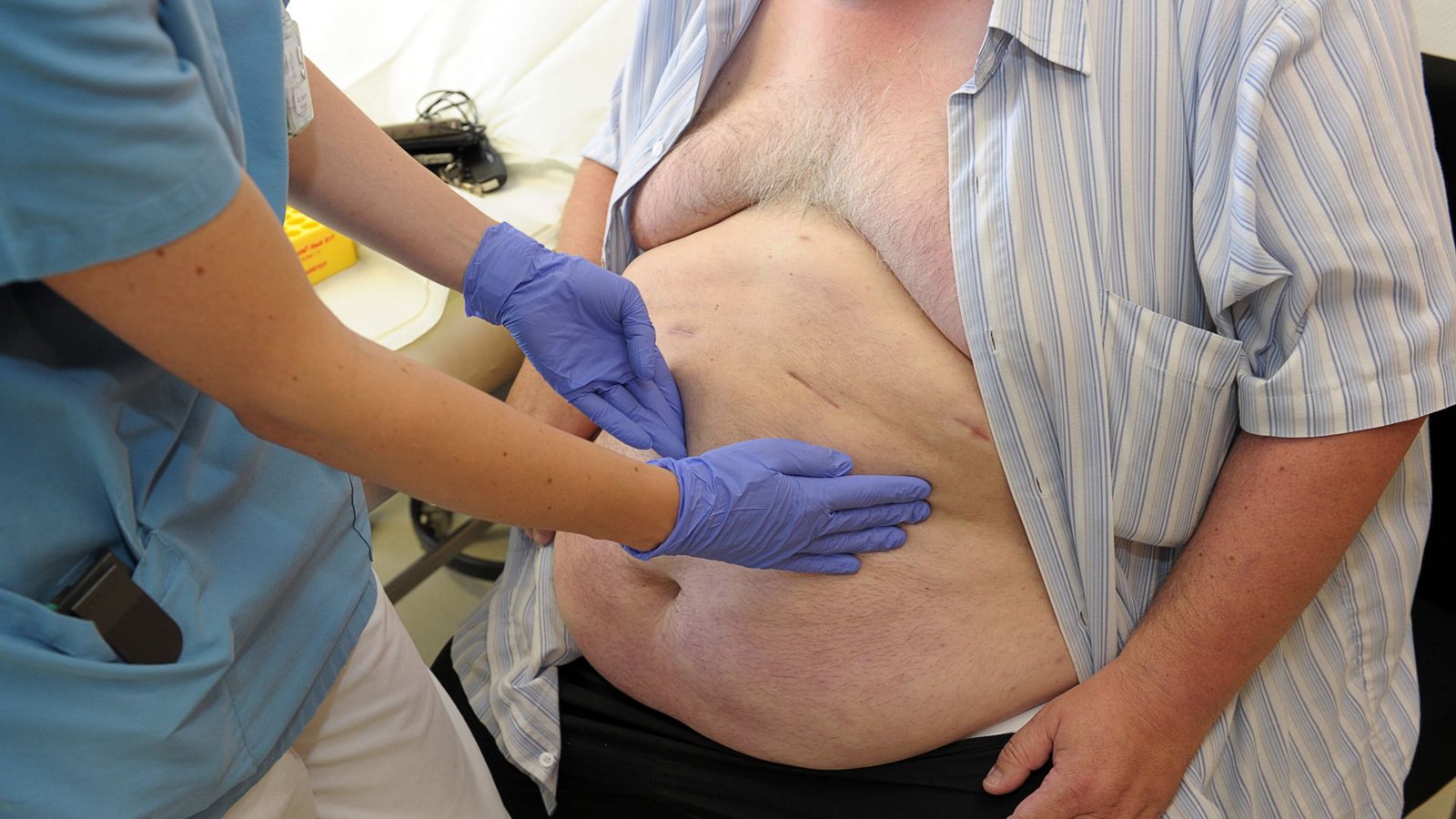 Als adipös gilt in Deutschland ein Mensch mit einem Body-Maß-Index (BMI) von 30 oder mehr. (Symbolbild)Foto: picture alliance / dpa/David Ebener Als adipös gilt in Deutschland ein Mensch mit einem Body-Maß-Index (BMI) von 30 oder mehr. (Symbolbild)Foto: picture alliance / dpa/David Ebener