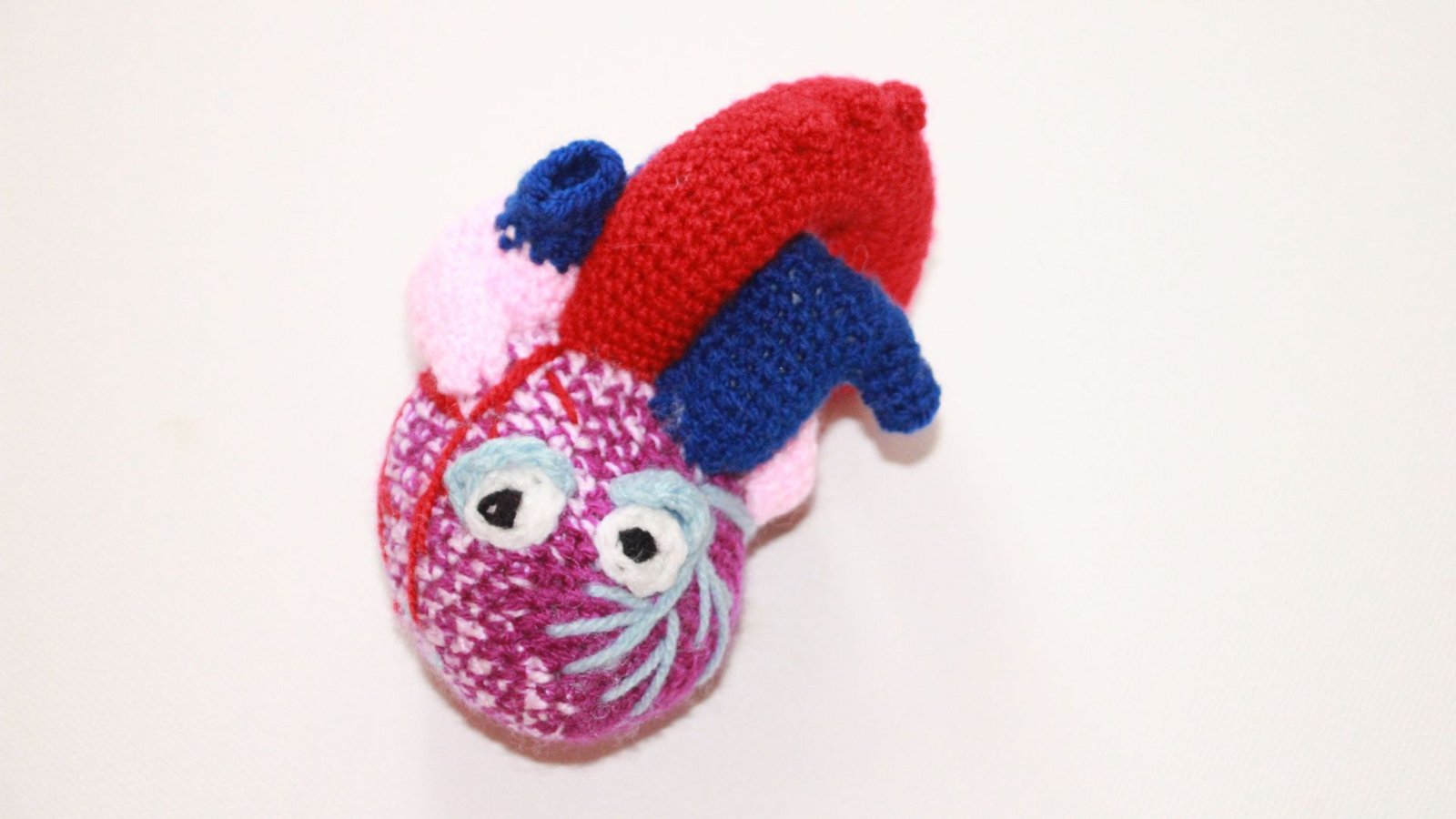 Herzmine von Bland-White-Garland - Herz mit ALCAPA-Syndrom (Anomalous Left Coronary Artery from the Pulmonary Artery). Spitzname und Lieblingstier: Alpaca. Ihr Lieblingssong: „heart attack“ von Demi Lovato. Ihre Stärke: versucht immer alles (auch jedes Sauerstoffmolekül) aus sich heraus zu holen. Ihre Schwäche: sehr schreckhaft und bekommt schnell einen HerzinfarktFoto: Mareen Kraft Herzmine von Bland-White-Garland - Herz mit ALCAPA-Syndrom (Anomalous Left Coronary Artery from the Pulmonary Artery). Spitzname und Lieblingstier: Alpaca. Ihr Lieblingssong: „heart attack“ von Demi Lovato. Ihre Stärke: versucht immer alles (auch jedes Sauerstoffmolekül) aus sich heraus zu holen. Ihre Schwäche: sehr schreckhaft und bekommt schnell einen HerzinfarktFoto: Mareen Kraft