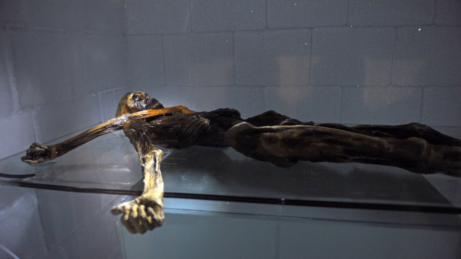 Schon der Gletschermann Ötzi war mit dem krebserregenden HPV16-Virus infiziert – und das vor 5.300 Jahren.Foto: mago/MiS Schon der Gletschermann Ötzi war mit dem krebserregenden HPV16-Virus infiziert – und das vor 5.300 Jahren.Foto: mago/MiS