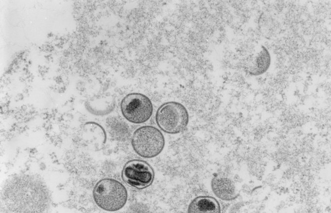 Laut den Forschern kann das Virus durch Sperma übertragen werden.<span class='image-autor'>Foto: dpa/Freya Kaulbars</span>