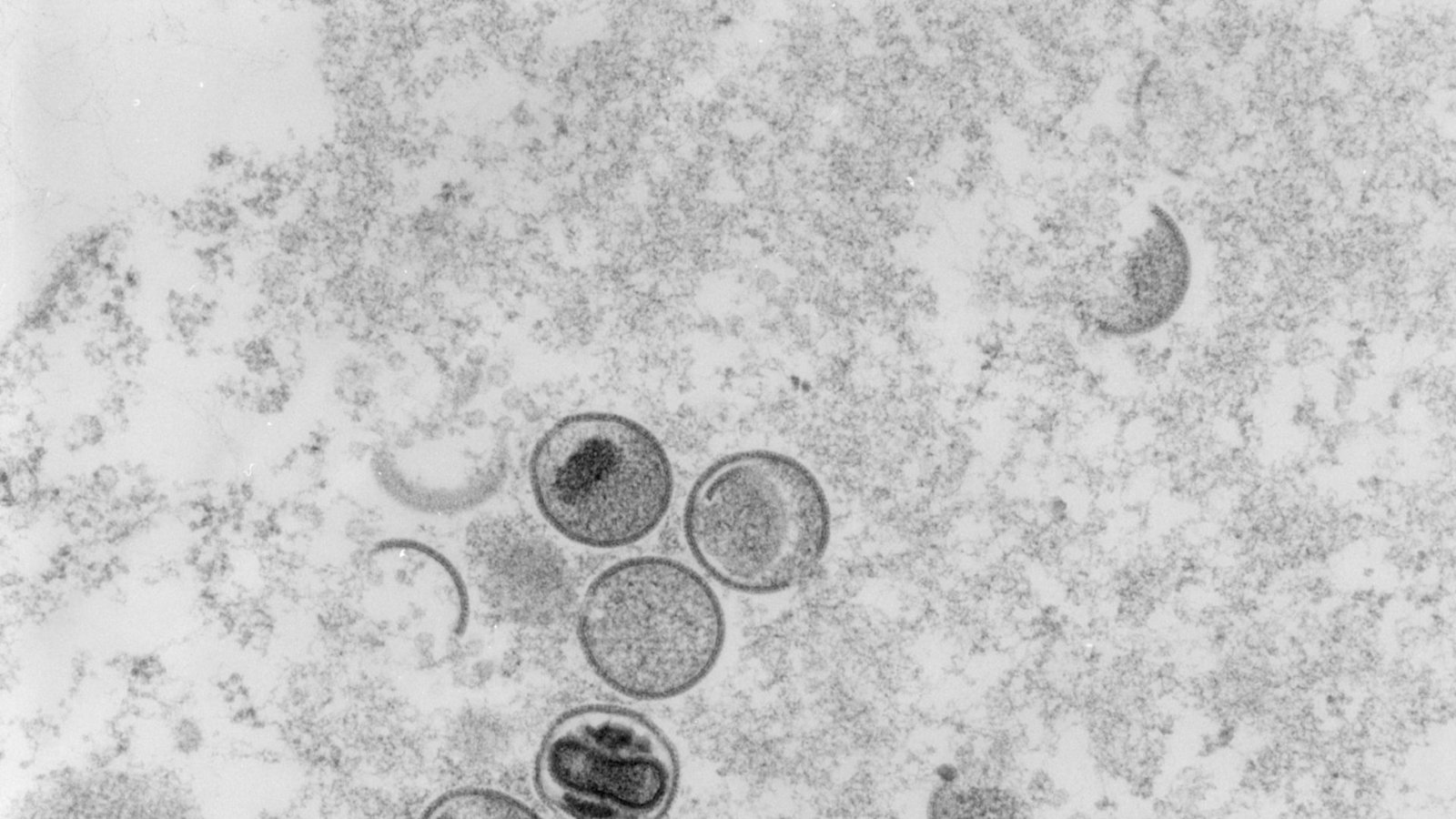 Laut den Forschern kann das Virus durch Sperma übertragen werden.Foto: dpa/Freya Kaulbars