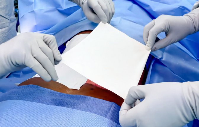 Die Ersatzhaut ist eine papierähnliche Membran, die auf Verbrennungswunden zweiten Grades aufgelegt werden kann, bis das Gewebe verheilt ist.<span class='image-autor'>Foto: PMI Polymedics Inovations GmbH</span>