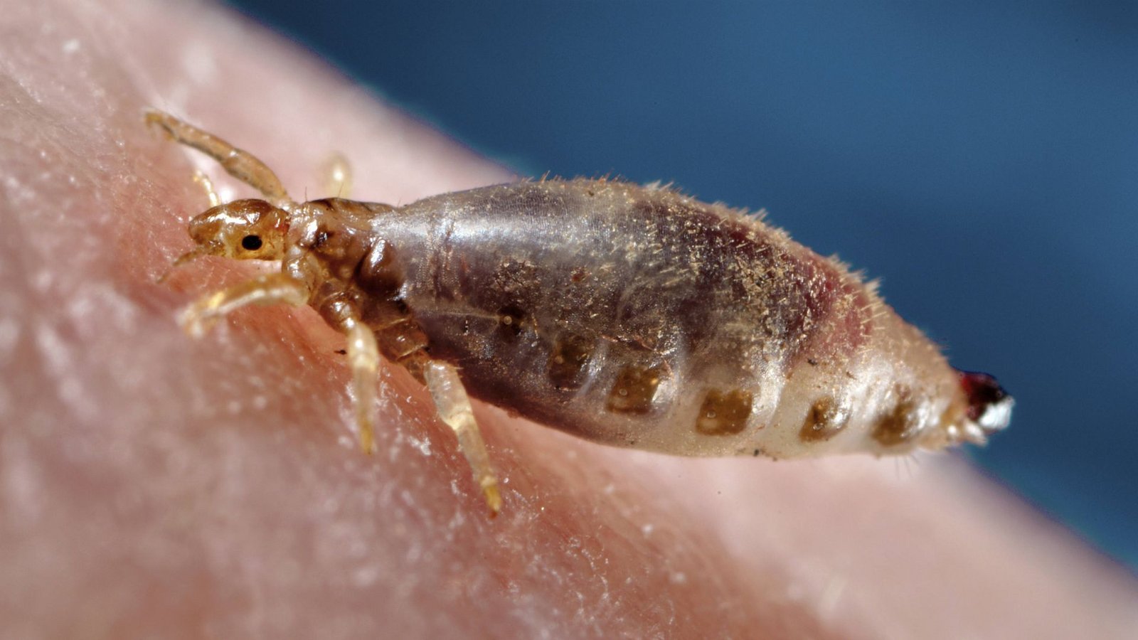 Die Kleiderlaus ist ein auf den Menschen spezialisierter blutsaugender Ektoparasit und Überträger von Krankheitserregern wie dem Pest-Bakterium.Foto: Imago/BISP Die Kleiderlaus ist ein auf den Menschen spezialisierter blutsaugender Ektoparasit und Überträger von Krankheitserregern wie dem Pest-Bakterium.Foto: Imago/BISP