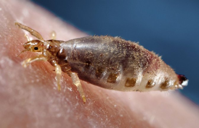 Die Kleiderlaus ist ein auf den Menschen spezialisierter blutsaugender Ektoparasit und  Überträger von Krankheitserregern wie dem Pest-Bakterium.<span class='image-autor'>Foto: Imago/BISP</span>