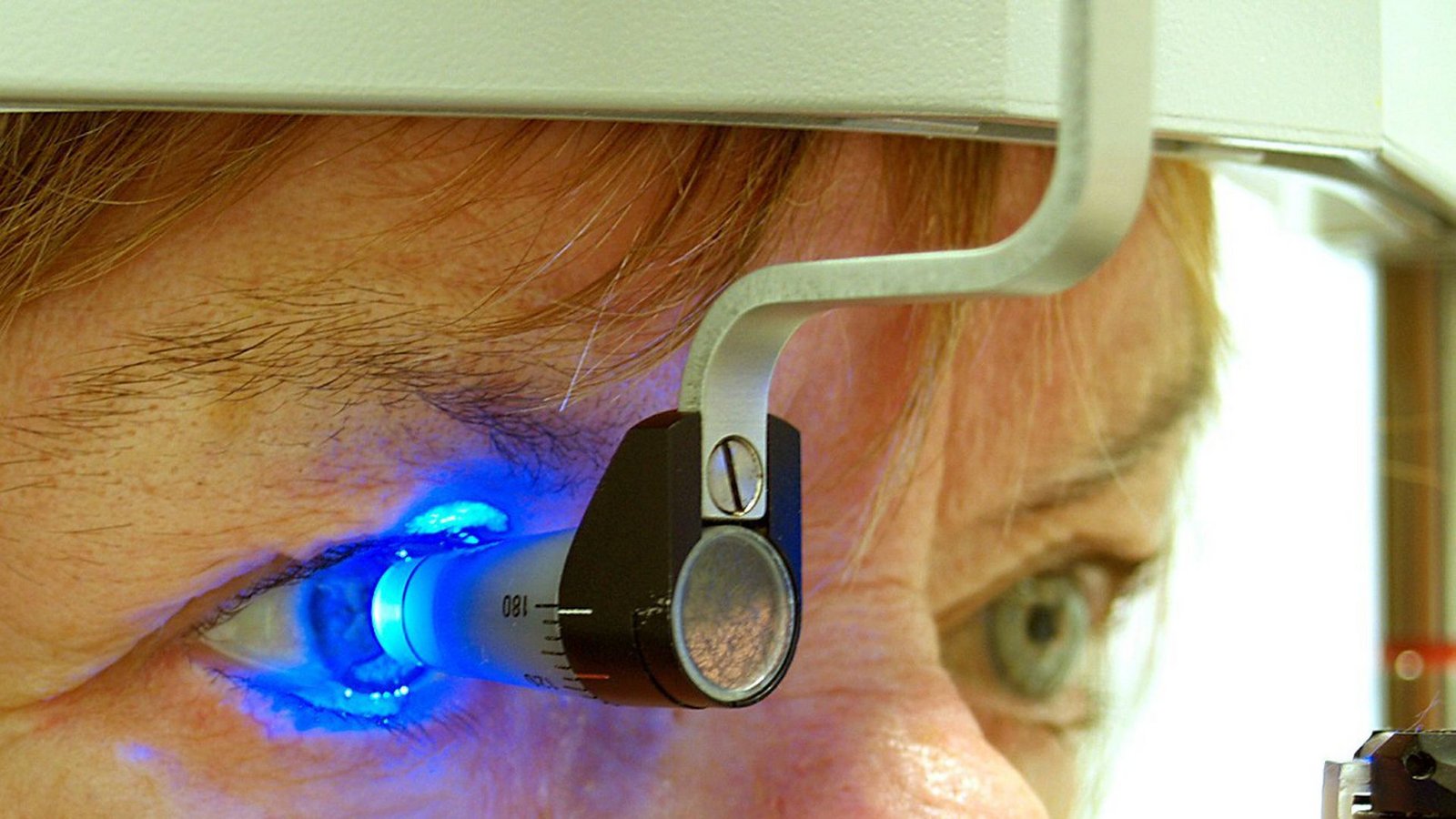 Die Augeninnendruckmessung steht weit oben auf der IGeL-Liste. Sie soll bei der Früherkennung des Grünen Stars helfen.Foto: dpa//Augenklinik Marzahn Die Augeninnendruckmessung steht weit oben auf der IGeL-Liste. Sie soll bei der Früherkennung des Grünen Stars helfen.Foto: dpa//Augenklinik Marzahn
