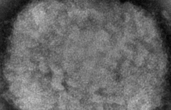 Die elektronenmikroskopische Aufnahme zeigt ein Affenpockenvirus.<span class='image-autor'>Foto: Cynthia S. Goldsmith/CDC via AP/dpa</span>