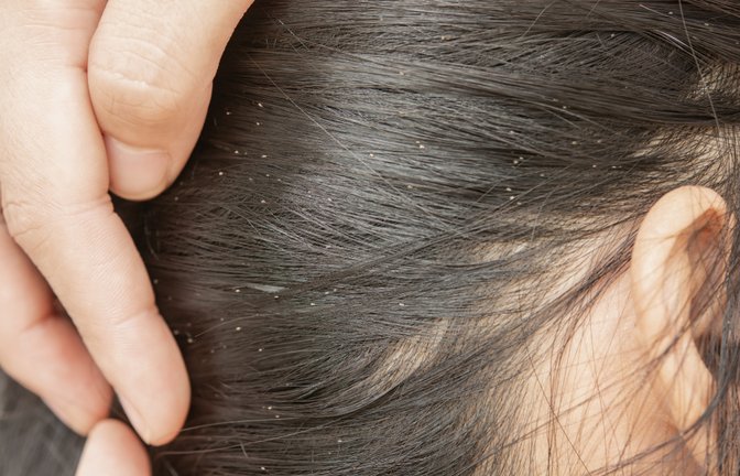 Muss man bei einem Befall auch die Bettwäsche wechseln?<span class='image-autor'>Foto: srisakorn wonglakorn / shutterstock.com</span>