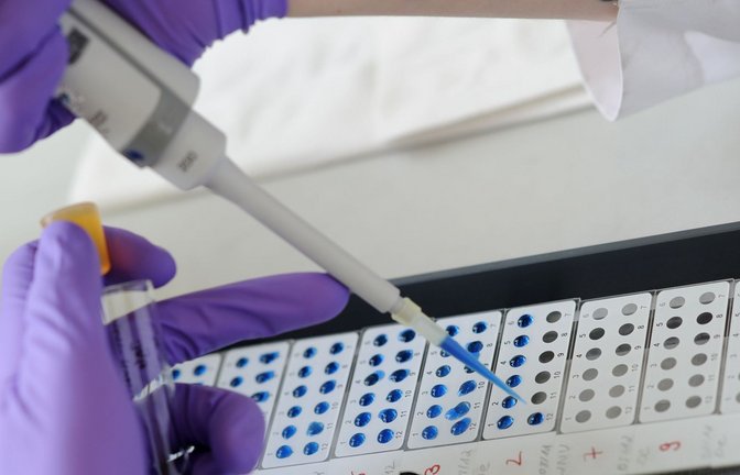 Experten in Baden-Württemberg haben sich zu dem Hantavirus geäußert. (Symbolbild)<span class='image-autor'>Foto: Angelika Warmuth/dpa/Angelika Warmuth</span>