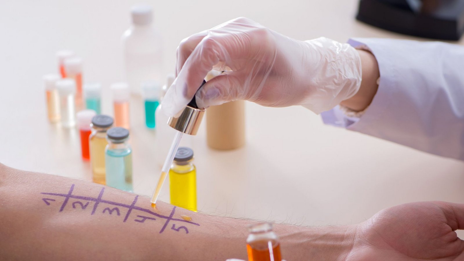 Ob eine Allergie vorliegt, kann der Arzt mit verschiedenen Tests untersuchen.Foto: imago images/Elnur/Elnur via www.imago-images.de Ob eine Allergie vorliegt, kann der Arzt mit verschiedenen Tests untersuchen.Foto: imago images/Elnur/Elnur via www.imago-images.de