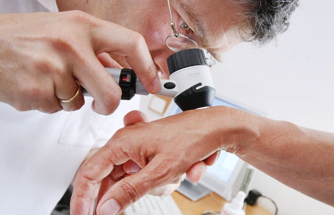 Die Zahl der Hautkrebs-Diagnosen ist in Baden-Württemberg deutlich gestiegen.<span class='image-autor'>Foto: picture alliance/dpa/Karl-Josef Hildenbrand</span>