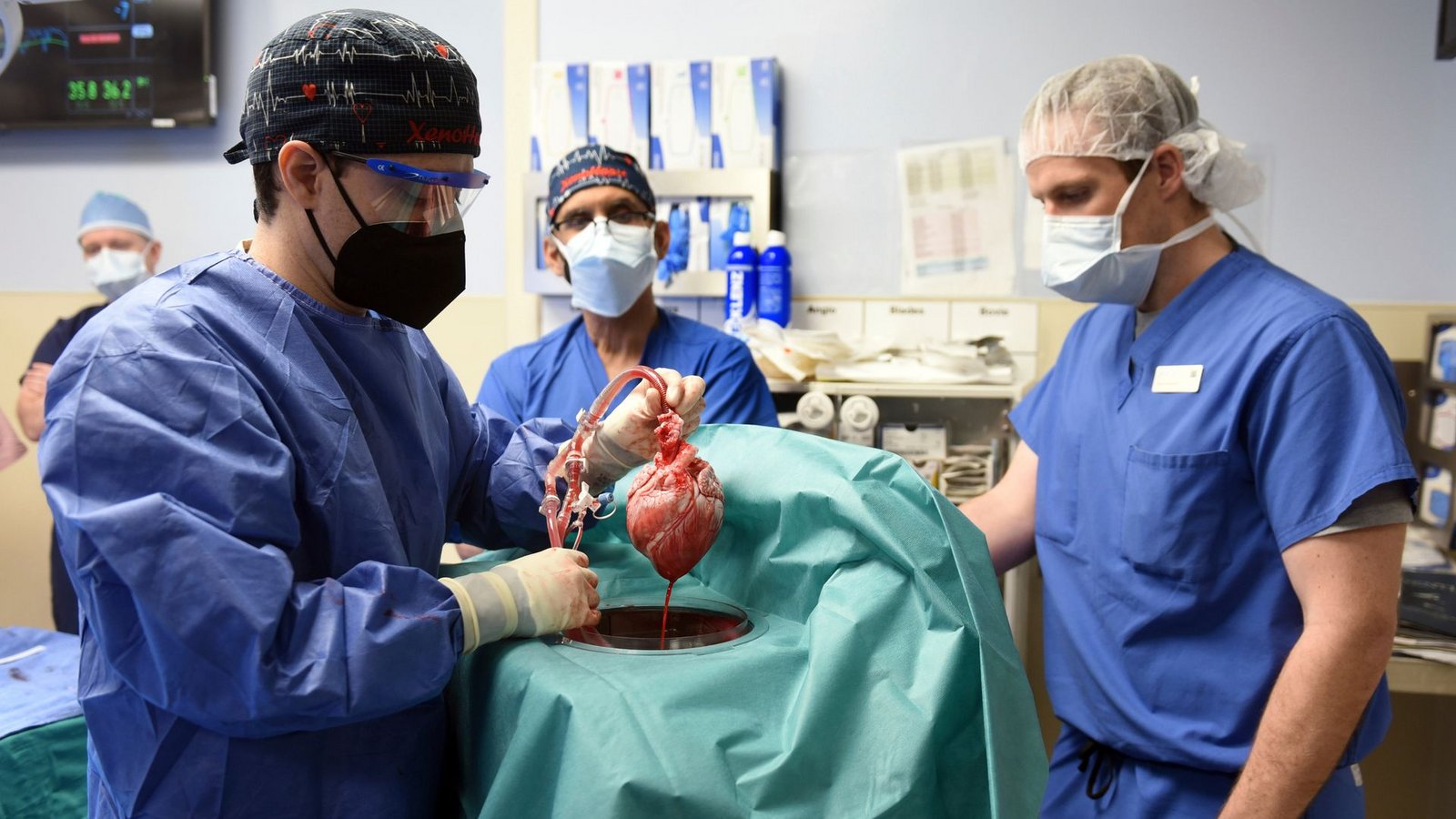 Die erste Transplantation eines Schweineherzens galt als Durchbruch auf dem Gebiet der Xenotransplantation.Foto: Mark Teske/University of Maryland School of Medicine/AP/dpa