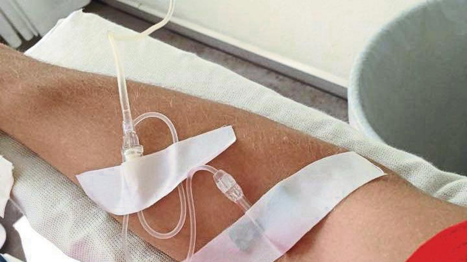 Der Tropf im Arm: Felix Franz musste sich nach seinem Zusammenbruch von einem Arzt Infusionen legen lassen. Foto: privat