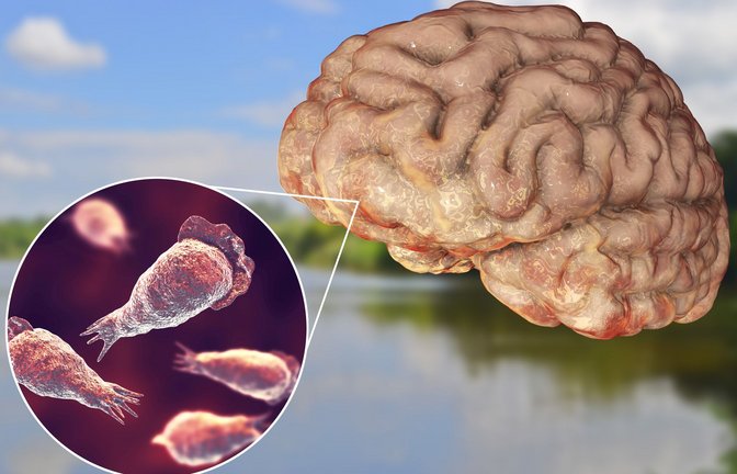 Wenn die Parasiten etwa beim Schwimmen in die Nase eines Menschen gelangen, können sie entlang des Riechnervs ins Gehirn vordringen und dort eine eitrige Hirnhautentzündung hervorrufen.<span class='image-autor'>Foto: Imago/Dreamstime</span>