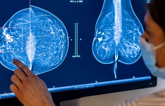 Die Möglichkeiten zur Mammographie für die Früherkennung von Brustkrebs soll ausgeweitet werden.<span class='image-autor'>Foto: Hannibal Hanschke/dpa</span>