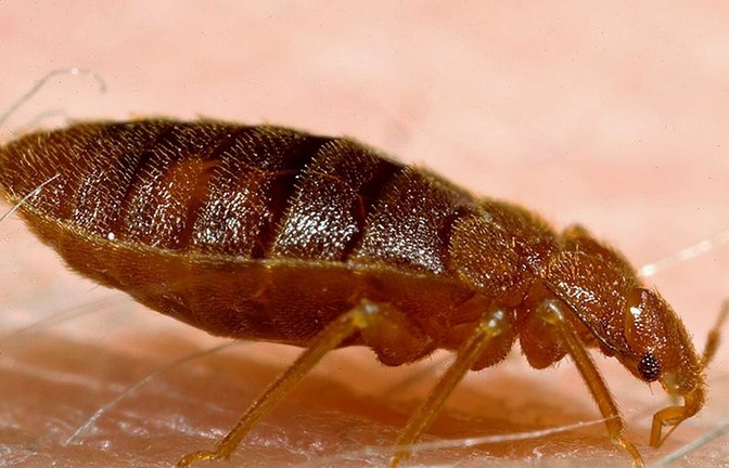 Eine Bettwanze beim Blutsaugen auf der menschlichen Haut (Symbolbild)<span class='image-autor'>Foto: dpa/Harvard University</span>