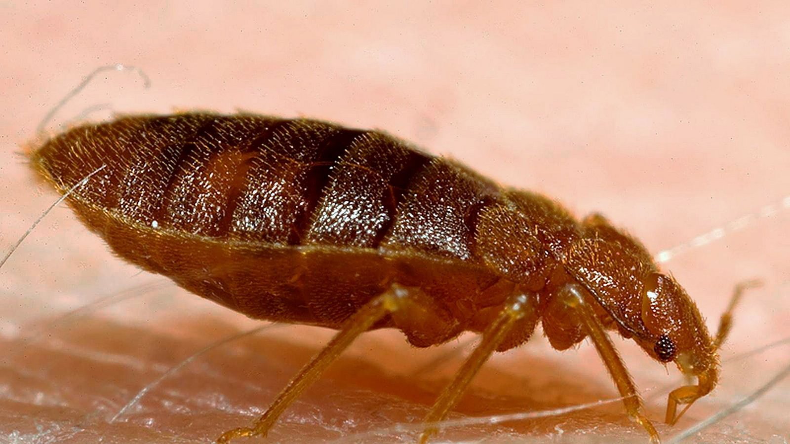 Eine Bettwanze beim Blutsaugen auf der menschlichen Haut (Symbolbild)Foto: dpa/Harvard University