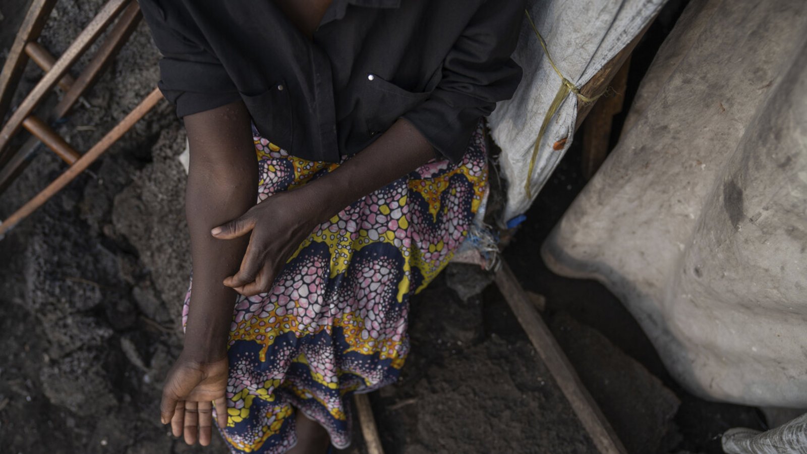 Vor allem in der Demokratischen Republik Kongo breitet sich das Virus aktuell aus.Vor allem in der Demokratischen Republik Kongo breitet sich das Virus aktuell aus.Foto: dpa/Moses Sawasawa Vor allem in der Demokratischen Republik Kongo breitet sich das Virus aktuell aus.Vor allem in der Demokratischen Republik Kongo breitet sich das Virus aktuell aus.Foto: dpa/Moses Sawasawa