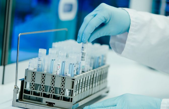 Ein Mitarbeiter hält in einem Coronatest-Labor PCR-Teströhrchen in den Händen.<span class='image-autor'>Foto: Uwe Anspach/dpa</span>