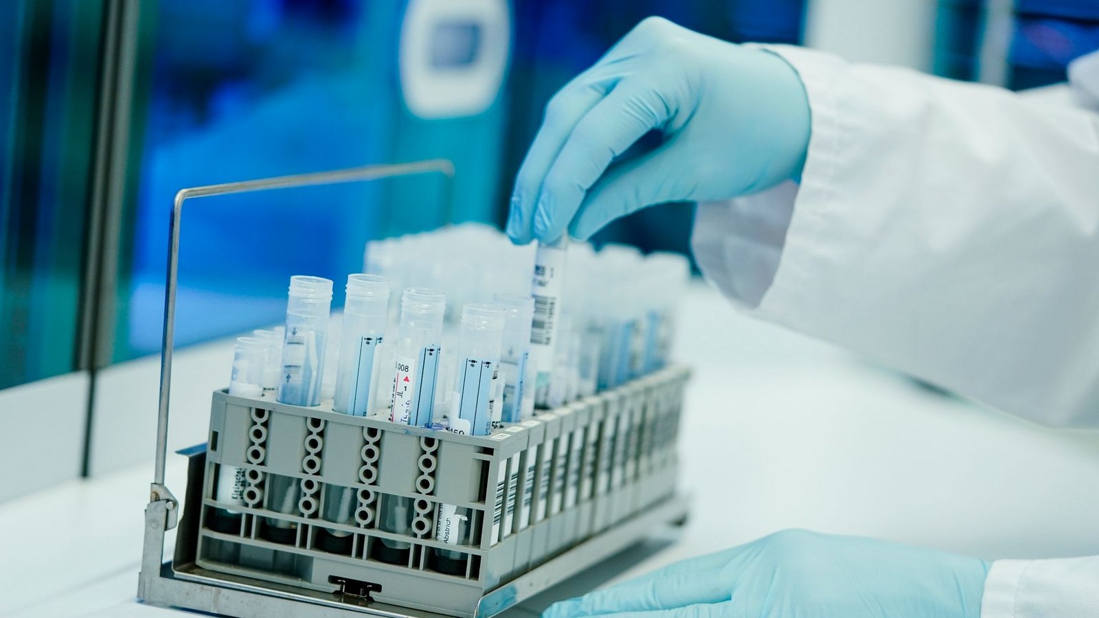 Ein Mitarbeiter hält in einem Coronatest-Labor PCR-Teströhrchen in den Händen.Foto: Uwe Anspach/dpa