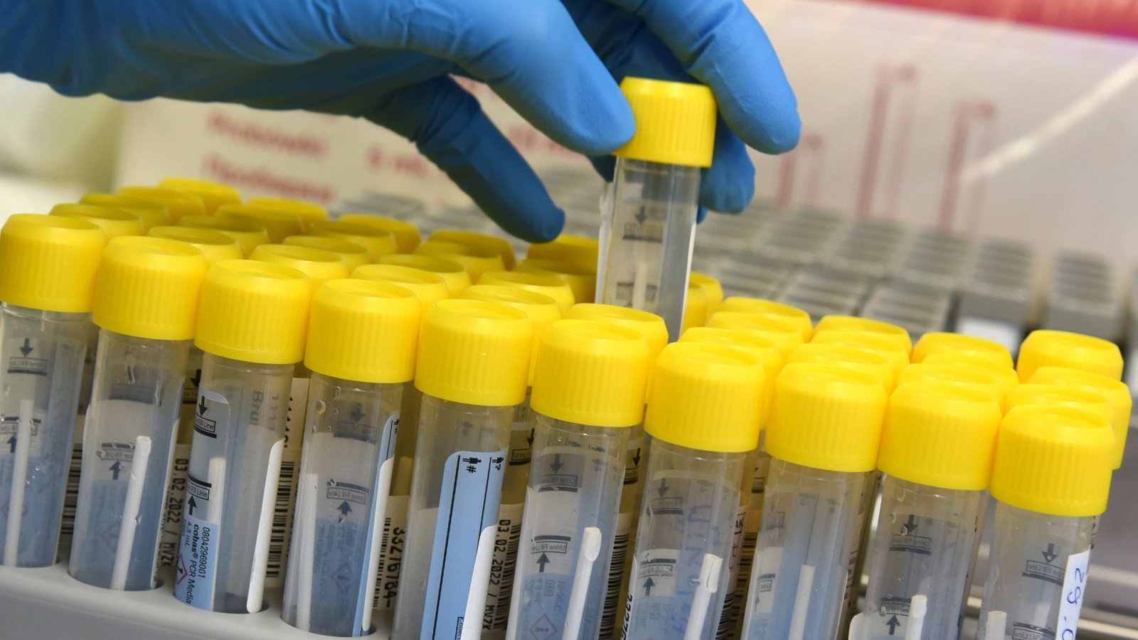 Coronainfektionen werden per Labortest nachgewiesen.Foto: dpa/Waltraud Grubitzsch