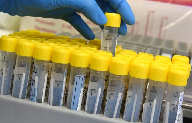 Coronainfektionen werden per Labortest nachgewiesen.<span class='image-autor'>Foto: dpa/Waltraud Grubitzsch</span>