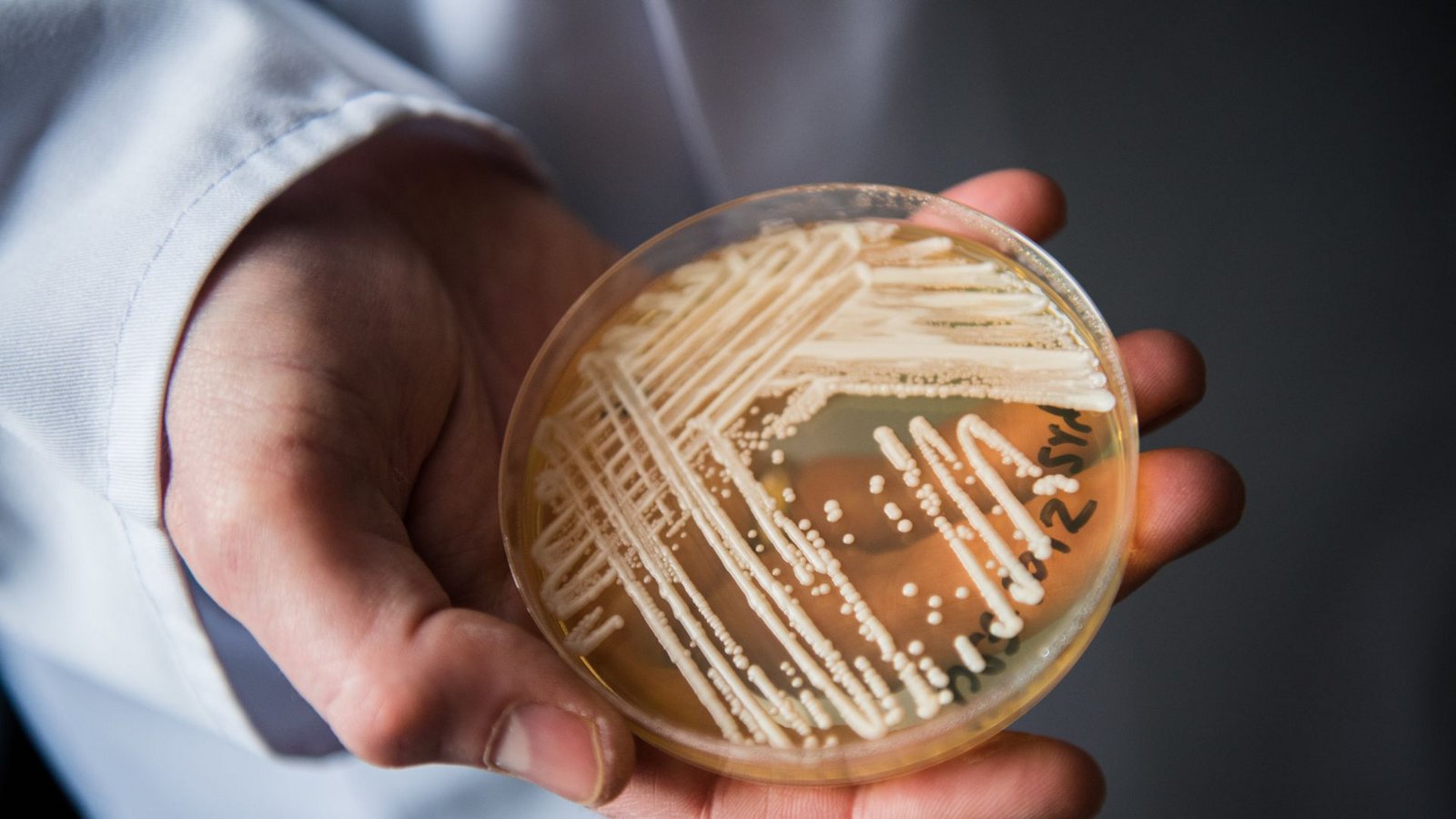 Der Hefepilz Candida auris, hier in einer Petrischale, breitet sich weltweit rasant aus.Foto: dpa/Nicolas Armer Der Hefepilz Candida auris, hier in einer Petrischale, breitet sich weltweit rasant aus.Foto: dpa/Nicolas Armer