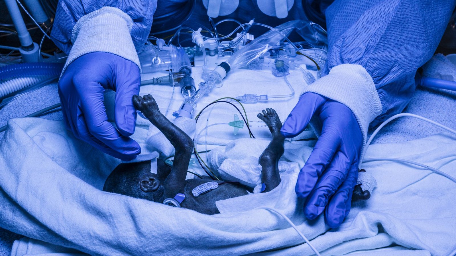 Ein Frühchen wird von  einer Pflegekraft versorgt: Dank spezieller medizinischer Einrichtungen in Reutlingen haben auch zu früh geborene Babys gute ÜberlebenschancenFoto: Andy Reiner