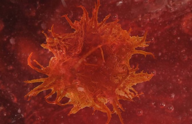 Krebs entsteht, wenn Mutationen im Erbgut (DNA) einer Zelle deren natürliche Wachstumskontrolle zerstören. Diese genetischen Veränderungen veranlassen die Zelle, sich unkontrolliert zu teilen, zu wachsen und sich dem programmierten Zelltod zu entziehen, was letztlich zur Tumorbildung führt.<span class='image-autor'>Imago/MITO</span>