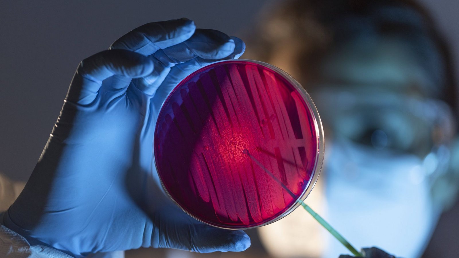 Im Labor wird analysiert, um welchen  Erreger es sich handelt: Candida auris oder eine andere Pilzart.Foto: imago/Addictive Stock/Victor Torres