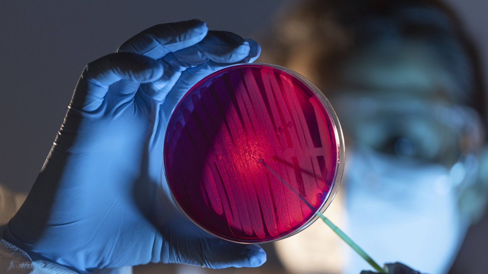 Im Labor wird analysiert, um welchen Erreger es sich handelt: Candida auris oder eine andere Pilzart.Foto: imago/Addictive Stock/Victor Torres Im Labor wird analysiert, um welchen Erreger es sich handelt: Candida auris oder eine andere Pilzart.Foto: imago/Addictive Stock/Victor Torres