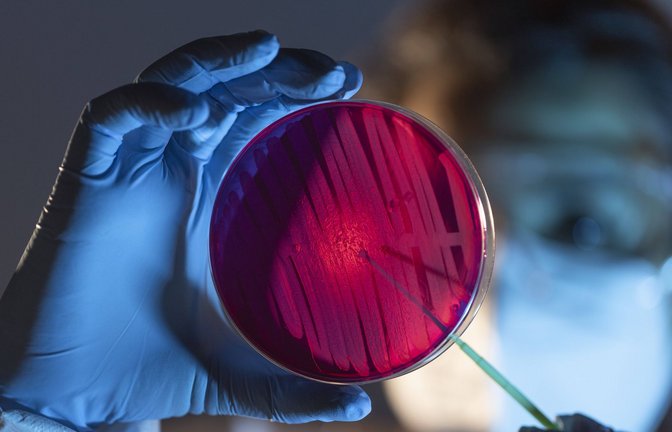 Im Labor wird analysiert, um welchen  Erreger es sich handelt: Candida auris oder eine andere Pilzart.<span class='image-autor'>Foto: imago/Addictive Stock/Victor Torres</span>