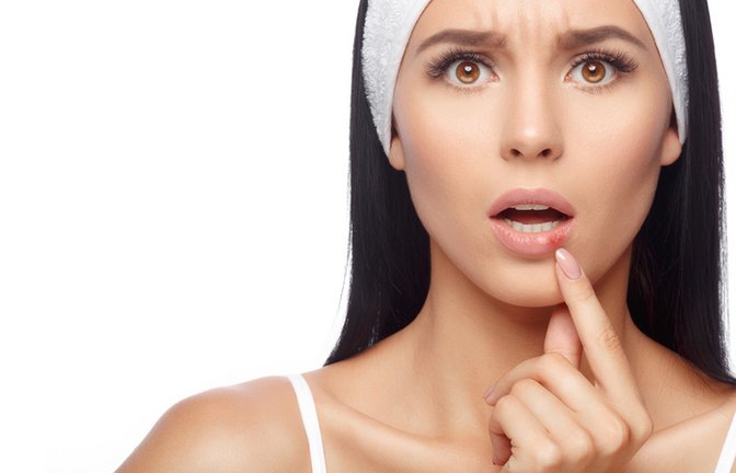 Kommt immer dann, wenn man ihn nicht brauchen kann: Lippenherpes.<span class='image-autor'>Foto: Lyashenko Egor / shutterstock.com</span>